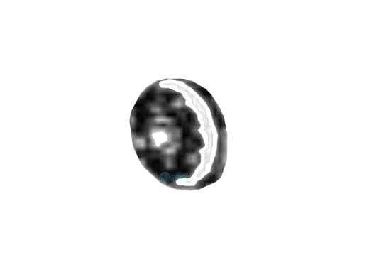 Maytronics Wheel for Side Panel Assembly | 9991085-ASSY